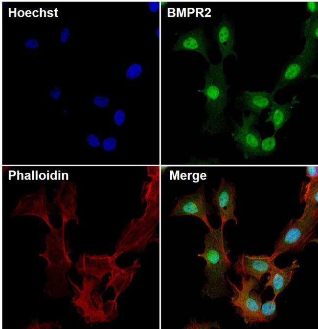 BMPR2 Antibody - BMPR2 Antibody in Immunofluorescence (IF)