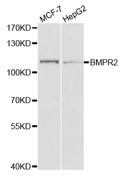 BMPR2 Antibody - Western blot analysis of extracts of various cell lines, using BMPR2 antibody.