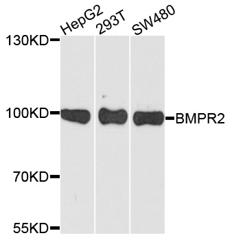 BMPR2 Antibody - Western blot analysis of extracts of various cells.