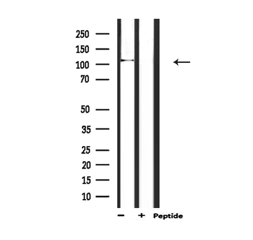 BMPR2 Antibody - Western blot analysis of extracts of mouse brain tissue using BMPR2 antibody.