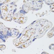 BMPR2 Antibody - Immunohistochemistry of paraffin-embedded Human placenta using BMPR2 Polyclonal Antibody at dilution of 1:100 (40x lens).