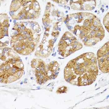 BMPR2 Antibody - Immunohistochemistry of paraffin-embedded Human stomach using BMPR2 Polyclonal Antibody at dilution of 1:100 (40x lens).