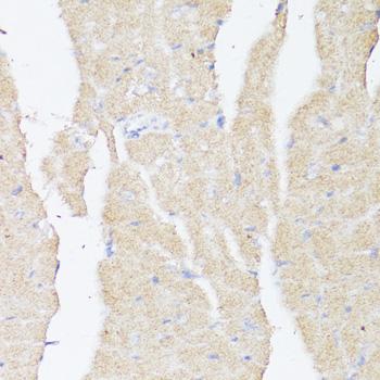 BMPR2 Antibody - Immunohistochemistry of paraffin-embedded Mouse heart using BMPR2 Polyclonal Antibody at dilution of 1:100 (40x lens).