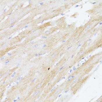 BMPR2 Antibody - Immunohistochemistry of paraffin-embedded Rat heart using BMPR2 Polyclonal Antibody at dilution of 1:100 (40x lens).