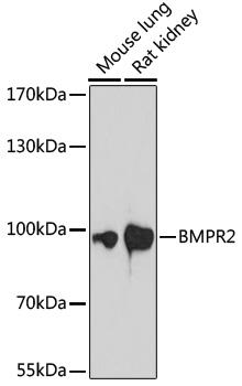 BMPR2 Antibody - Western blot analysis of extracts of various cell lines using BMPR2 Polyclonal Antibody at dilution of 1:1000.