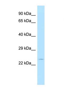 BMRP36a / MRPL43 Antibody - MRPL43 antibody Western blot of 721_B Cell lysate. Antibody concentration 1 ug/ml.  This image was taken for the unconjugated form of this product. Other forms have not been tested.