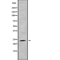 BMRP36a / MRPL43 Antibody - Western blot analysis of MRPL43 using HT29 whole cells lysates