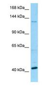 BMS1 Antibody - BMS1 antibody Western Blot of Fetal Kidney.  This image was taken for the unconjugated form of this product. Other forms have not been tested.