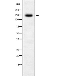 BMS1 Antibody - Western blot analysis of BMS1 using Jurkat whole cells lysates