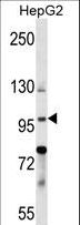 BNC1 / Basonuclin Antibody - BNC1 Antibody western blot of HepG2 cell line lysates (35 ug/lane). The BNC1 antibody detected the BNC1 protein (arrow).