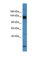 BNC1 / Basonuclin Antibody - BNC1 antibody Western blot of Mouse Intestine lysate. This image was taken for the unconjugated form of this product. Other forms have not been tested.
