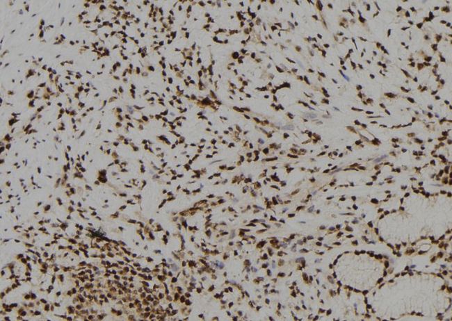 BNC1 / Basonuclin Antibody - 1:100 staining human gastric tissue by IHC-P. The sample was formaldehyde fixed and a heat mediated antigen retrieval step in citrate buffer was performed. The sample was then blocked and incubated with the antibody for 1.5 hours at 22°C. An HRP conjugated goat anti-rabbit antibody was used as the secondary.