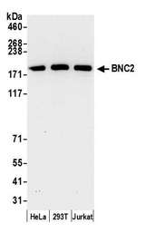 BNC2 Antibody - Detection of human BNC2 by western blot. Samples: Whole cell lysate (5 µg) from HeLa, HEK293T, and Jurkat cells prepared using NETN lysis buffer. Antibody: Affinity purified rabbit anti-BNC2 antibody used for WB at 0.1 µg/ml. Detection: Chemiluminescence with an exposure time of 30 seconds.