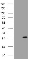 BNIP1 Antibody - HEK293T cells were transfected with the pCMV6-ENTRY control (Left lane) or pCMV6-ENTRY BNIP1 (Right lane) cDNA for 48 hrs and lysed. Equivalent amounts of cell lysates (5 ug per lane) were separated by SDS-PAGE and immunoblotted with anti-BNIP1.