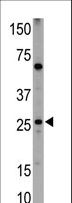 BNIP1 Antibody - Western blot of anti-NIP1 BH3 Domain antibody in HL60 cell lysates (35 ug/lane). NIP1 BH3 Domain (arrow) was detected using the purified antibody.