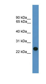 BNIP1 Antibody - BNIP1 antibody Western blot of Fetal Liver lysate.  This image was taken for the unconjugated form of this product. Other forms have not been tested.