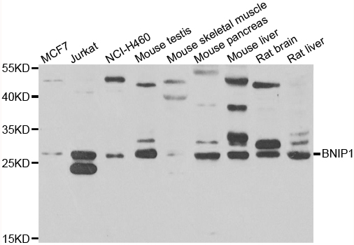 BNIP1 Antibody - Western blot analysis of extracts of various cell lines.