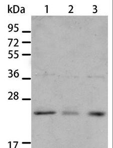 BNIP1 Antibody - Western blot analysis of A431 and A172 cell, human liver cancer tissue, using BNIP1 Polyclonal Antibody at dilution of 1:550.