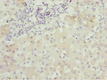 BNIP1 Antibody - Immunohistochemistry of paraffin-embedded human liver tissue at dilution 1:100