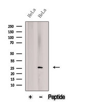 BNIP1 Antibody - Western blot analysis of extracts of HeLa cells using BNIP1 antibody. The lane on the left was treated with blocking peptide.