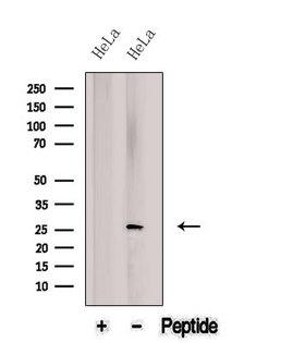 BNIP1 Antibody - Western blot analysis of extracts of HeLa cells using BNIP1 antibody. The lane on the left was treated with blocking peptide.