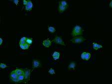 BNIP1 Antibody - Immunofluorescence staining of BNIP1 in MCF7 cells. Cells were fixed with 4% PFA, permeabilzed with 0.1% Triton X-100 in PBS, blocked with 10% serum, and incubated with rabbit anti-Human BNIP1 polyclonal antibody (dilution ratio 1:200) at 4°C overnight. Then cells were stained with the Alexa Fluor 488-conjugated Goat Anti-rabbit IgG secondary antibody (green) and counterstained with DAPI (blue). Positive staining was localized to Cytoplasm.