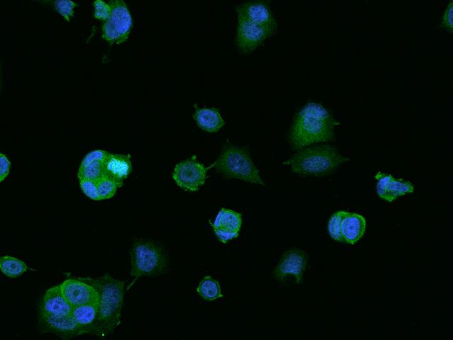BNIP1 Antibody - Immunofluorescence staining of BNIP1 in MCF7 cells. Cells were fixed with 4% PFA, permeabilzed with 0.1% Triton X-100 in PBS, blocked with 10% serum, and incubated with rabbit anti-Human BNIP1 polyclonal antibody (dilution ratio 1:200) at 4°C overnight. Then cells were stained with the Alexa Fluor 488-conjugated Goat Anti-rabbit IgG secondary antibody (green) and counterstained with DAPI (blue). Positive staining was localized to Cytoplasm.