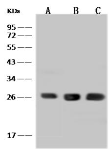 BNIP1 Antibody - Anti-BNIP1 rabbit polyclonal antibody at 1:500 dilution. Lane A: HepG2 Whole Cell Lysate. Lane B: Jurkat Whole Cell Lysate. Lane C: U-251 MG Whole Cell Lysate. Lysates/proteins at 30 ug per lane. Secondary: Goat Anti-Rabbit IgG (H+L)/HRP at 1/10000 dilution. Developed using the ECL technique. Performed under reducing conditions. Predicted band size: 26 kDa. Observed band size: 26 kDa.