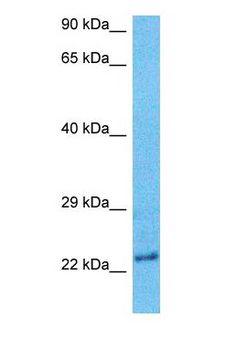 BNIP1 Antibody - Western blot of BNIP1 Antibody with human Jurkat Whole Cell lysate.  This image was taken for the unconjugated form of this product. Other forms have not been tested.