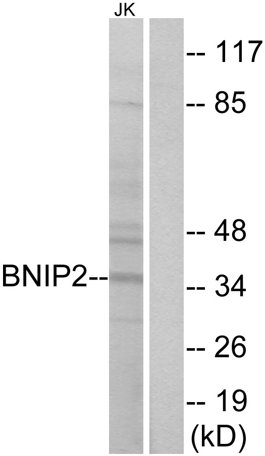 BNIP2 Antibody - Western blot analysis of lysates from Jurkat cells, using BNIP2 Antibody. The lane on the right is blocked with the synthesized peptide.