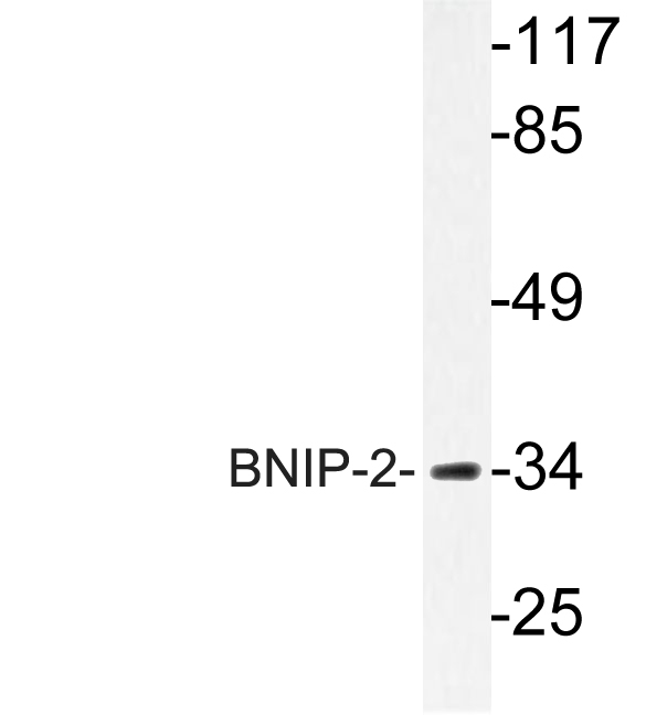 BNIP2 Antibody - Western blot analysis of lysate from Jurkat cells, using BNIP-2 antibody.