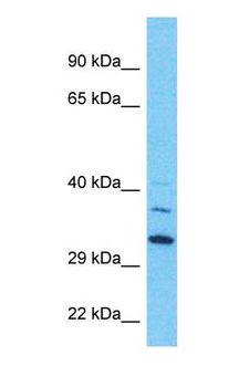 BNIP2 Antibody - Western blot of BNIP2 Antibody with human 721_B Whole Cell lysate.  This image was taken for the unconjugated form of this product. Other forms have not been tested.