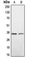 BNIP2 Antibody - Western blot analysis of BNIP2 expression in HEK293T (A); mouse liver (B) whole cell lysates.