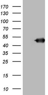 BNIP2 Antibody - HEK293T cells were transfected with the pCMV6-ENTRY control (Left lane) or pCMV6-ENTRY BNIP2 (Right lane) cDNA for 48 hrs and lysed. Equivalent amounts of cell lysates (5 ug per lane) were separated by SDS-PAGE and immunoblotted with anti-BNIP2.