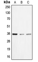 BNIP2 Antibody - Western blot analysis of BNIP2 expression in HEK293T (A); mouse liver (B); rat liver (C) whole cell lysates.