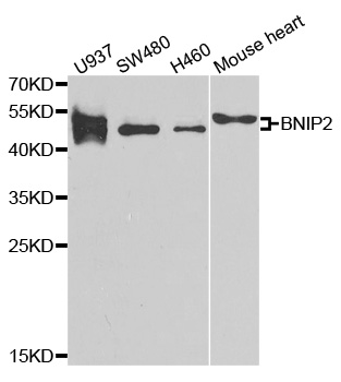 BNIP2 Antibody - Western blot analysis of extracts of various cell lines.