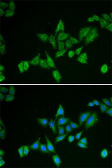 BNIP2 Antibody - Immunofluorescence analysis of HeLa cells.
