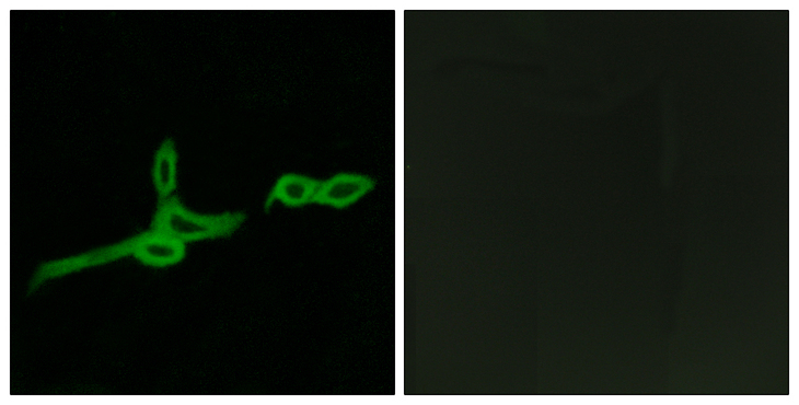 BOB / GPR15 Antibody - Immunofluorescence analysis of LOVO cells, using GPR15 Antibody. The picture on the right is blocked with the synthesized peptide.