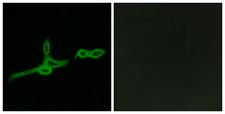 BOB / GPR15 Antibody - Immunofluorescence analysis of LOVO cells, using GPR15 Antibody. The picture on the right is blocked with the synthesized peptide.