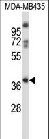 BOB / GPR15 Antibody - GPR15 Antibody western blot of MDA-MB435 cell line lysates (35 ug/lane). The GPR15 antibody detected the GPR15 protein (arrow).