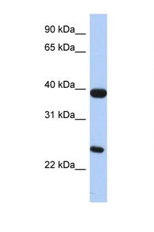 BOB / GPR15 Antibody - GPR15 antibody Western blot of Small Intestine lysate. Antibody concentration 1 ug/ml. This image was taken for the unconjugated form of this product. Other forms have not been tested.