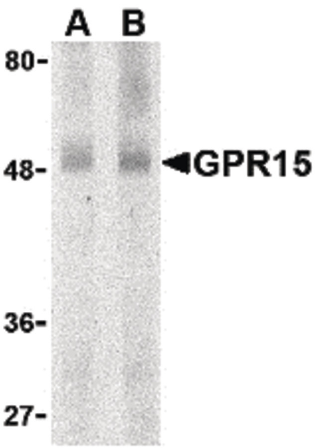 BOB / GPR15 Antibody - Western blot of GPR15 in human spleen lysate with GPR15 antibody at (A) 0.5 and (B) 1 ug/ml.