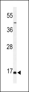 BOD1 Antibody - Western blot of FAM44B Antibody in MCF-7 cell line lysates (35 ug/lane). FAM44B (arrow) was detected using the purified antibody.