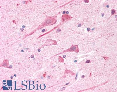 BOD1L1 / BOD1L Antibody - Human Brain, Cortex: Formalin-Fixed, Paraffin-Embedded (FFPE)