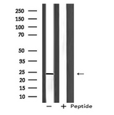 BOK Antibody - Western blot analysis of BOK using PC-3 whole cells lysates