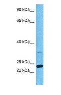 BOK Antibody - Western blot of BOK Antibody with human MCF7 Whole Cell lysate.  This image was taken for the unconjugated form of this product. Other forms have not been tested.