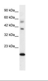 BOLA1 Antibody - Fetal Heart Lysate.  This image was taken for the unconjugated form of this product. Other forms have not been tested.