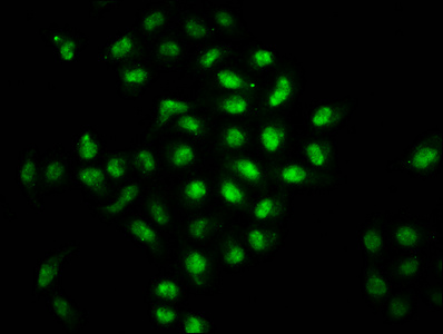 BOLA2 Antibody - Immunofluorescence staining of Hela cells diluted at 1:66, counter-stained with DAPI. The cells were fixed in 4% formaldehyde, permeabilized using 0.2% Triton X-100 and blocked in 10% normal Goat Serum. The cells were then incubated with the antibody overnight at 4°C.The Secondary antibody was Alexa Fluor 488-congugated AffiniPure Goat Anti-Rabbit IgG (H+L).