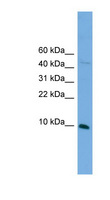 BOLA2 Antibody - BOLA2 antibody Western blot of SP2/0 cell lysate. This image was taken for the unconjugated form of this product. Other forms have not been tested.