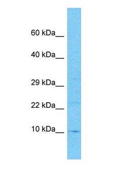 BOLA3 Antibody - Western blot of BOLA3 Antibody with human MDA-MB-435s Whole Cell lysate.  This image was taken for the unconjugated form of this product. Other forms have not been tested.
